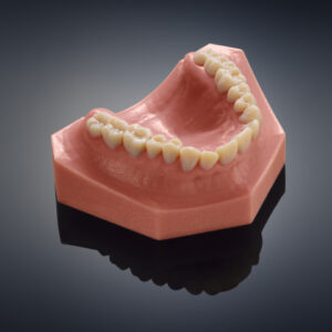 Dentadura hecha mediante impresión 3D